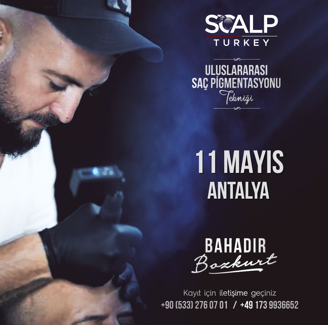 11 Mayıs 2024 Antalya Workshop | Scalp Turkey